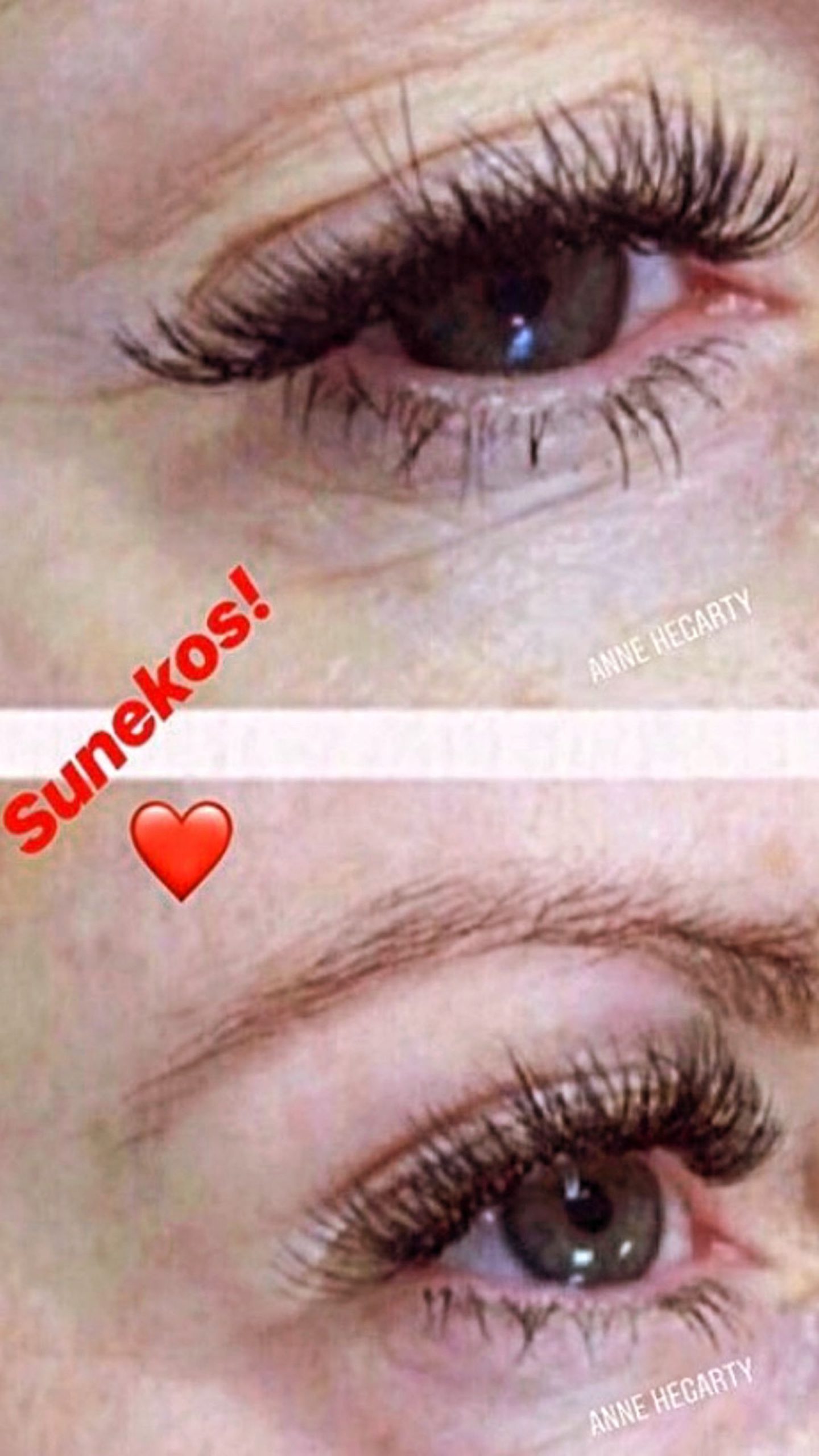 Sunekos Anne Hegarty Cosmeticare