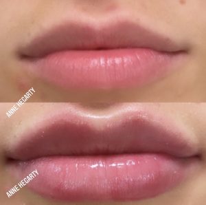 Anne Hegarty Cosmeticare - Lips to Love!