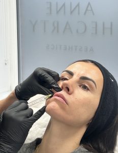 Anne Hegarty Cosmeticare - Profhilo